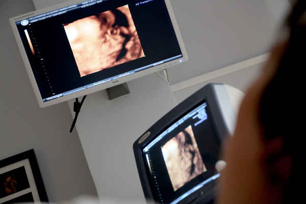 An ultrasound scan in progress