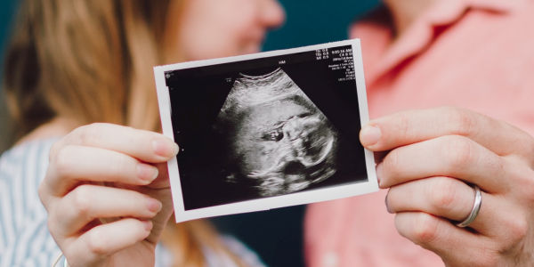 Mother and father holding ultrasound image.